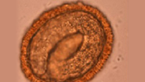 Baylisascaris egg Ebryonated B. procyonis egg.