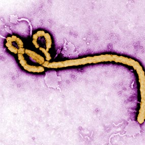 Ebola virus