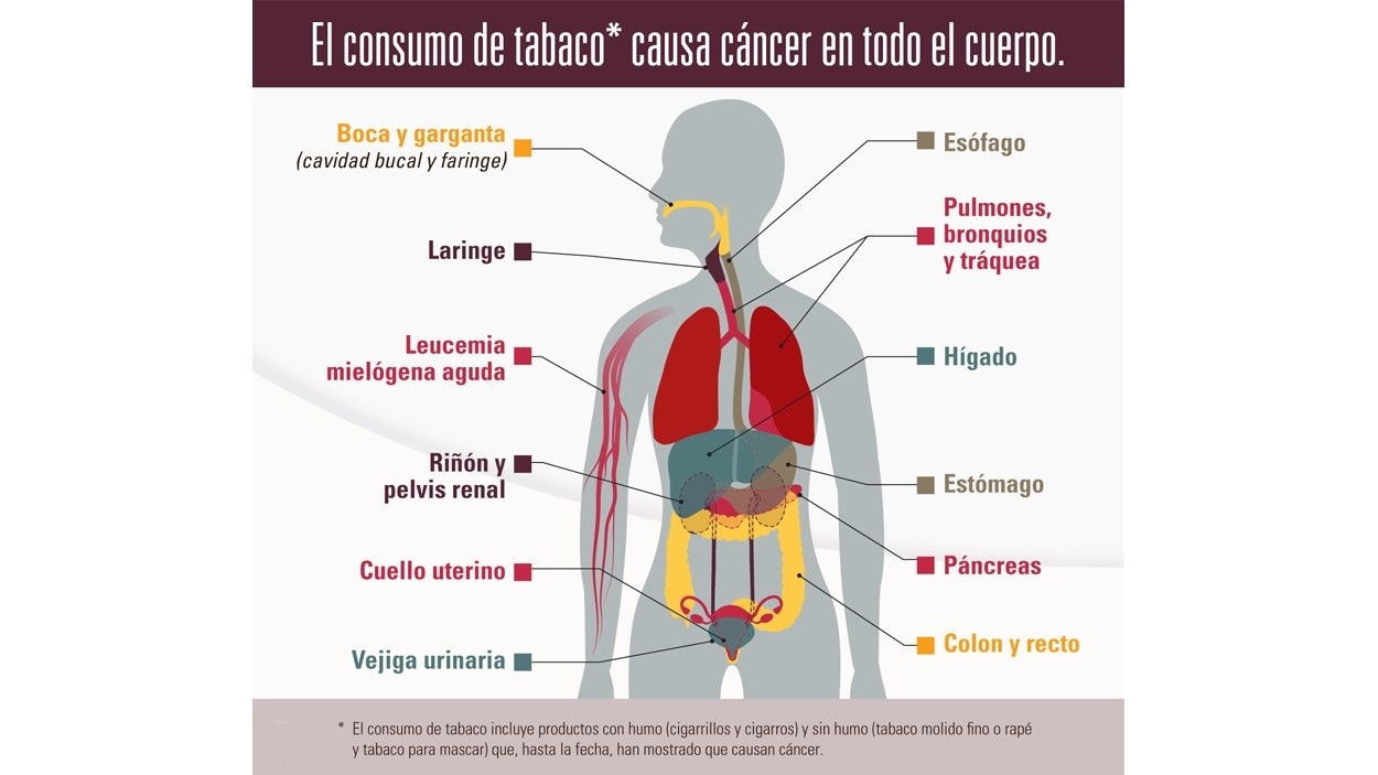 El consumo de tabaco causa cáncer en todo el cuerpo. El consumo de tabaco incluye productos con humo (cigarrillos y cigarros) y sin humo (tabaco molido fino o rapé y tabaco para mascar) que, hasta la fecha, han mostrado que causan cáncer.