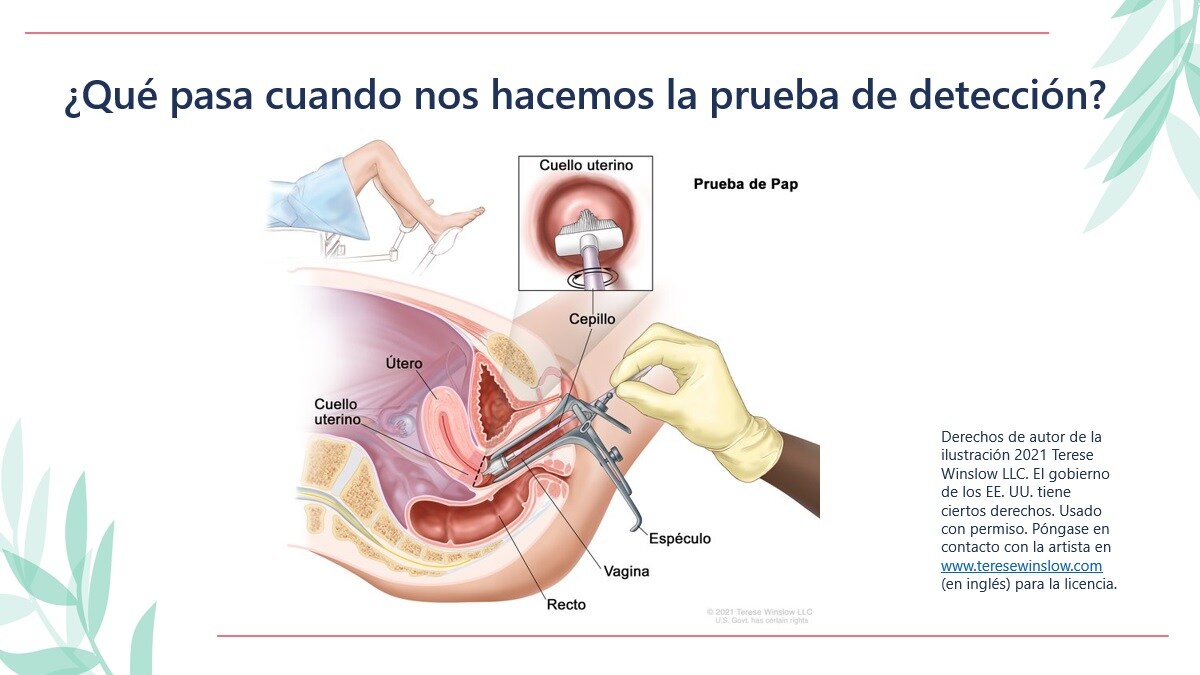 Diagrama de una prueba de detección del cáncer de cuello uterino