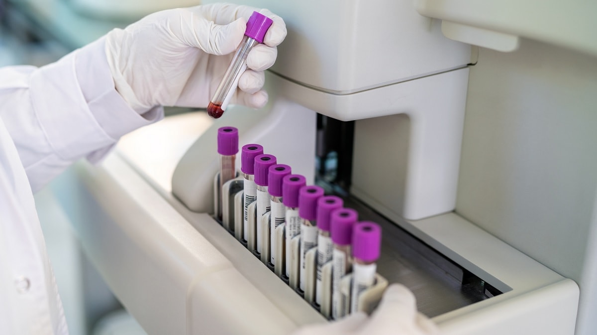 A laboratory technician looks at blood samples in a machine