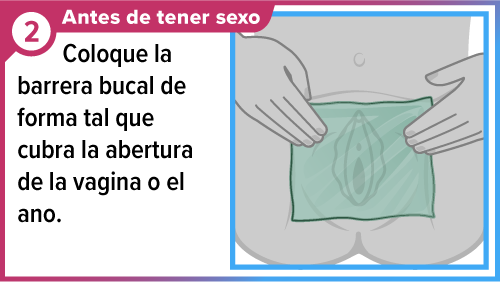 Manos sosteniendo la barrera bucal sobre la vulva.