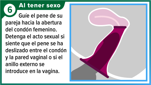 Condón femenino colocado, con el pene insertado dentro de la vagina.