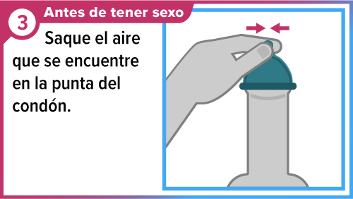 Mano pellizcando la punta del condón para crear un espacio.