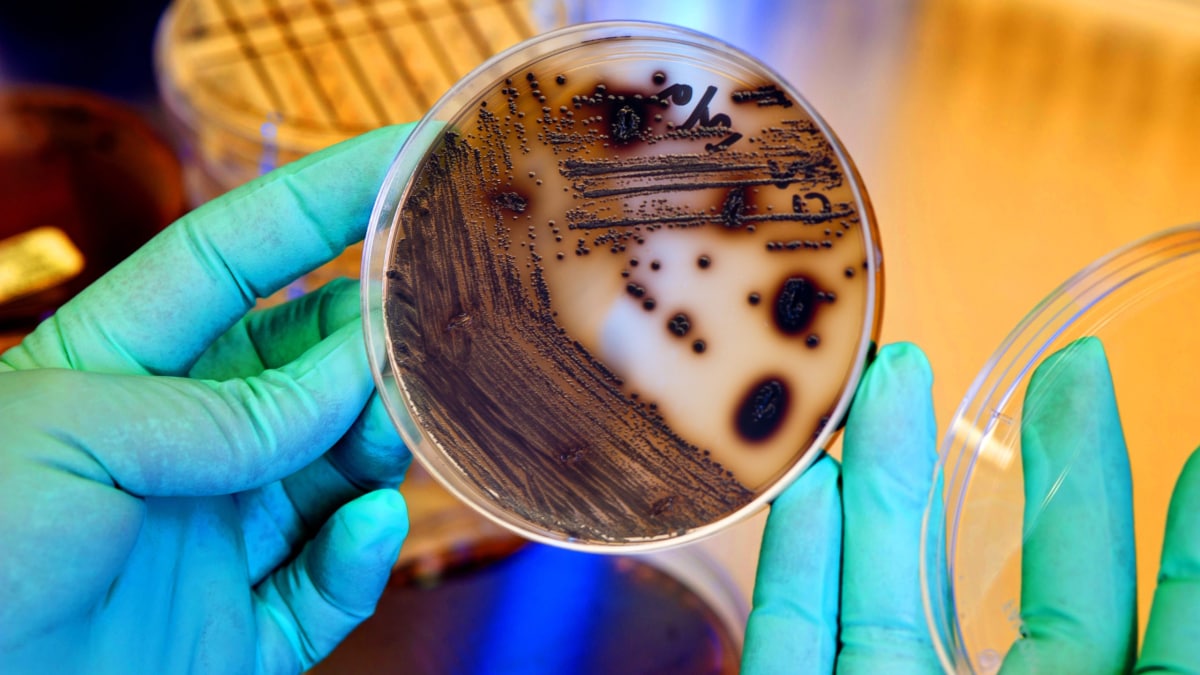 Diphtheria bacteria growing on a Tinsdale plate.