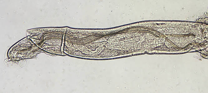 Angio_10x_spicules_web.jpg
