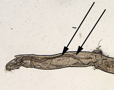 Angio_4x_spicules_annot_web.jpg