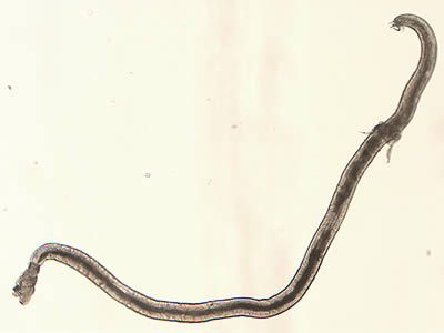 Angio_4x_whole_web.jpg