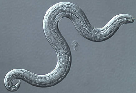 Angio3_dic_400x.jpg