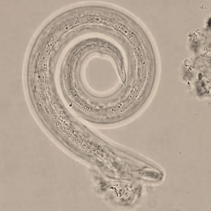 HI_slug5_tail_400x.jpg