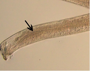 L5_spicule1 Figure B