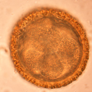 BaylisEgg_WKU3.jpg