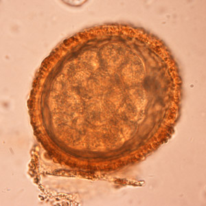 BaylisEgg_WKU4.jpg
