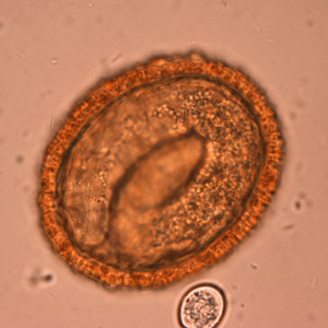 BaylisEgg_WKU5.jpg