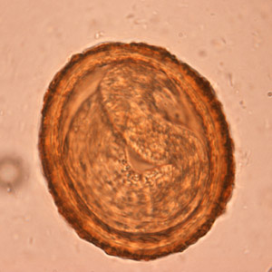 BaylisEgg_WKU6.jpg