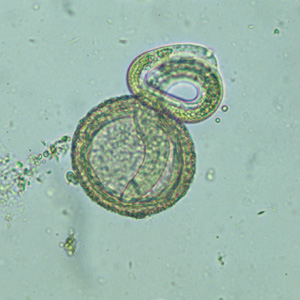 Baylisascaris_larva_hatching_CA1.jpg