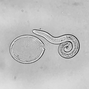 New_Larva_B Figure B