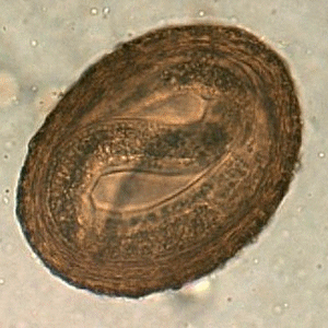 Raccoon-Baylisascaris-egg-f.gif Figure A