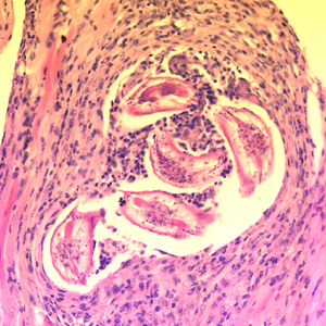 Baylisascaris_muscle_200x_BAM1.jpg