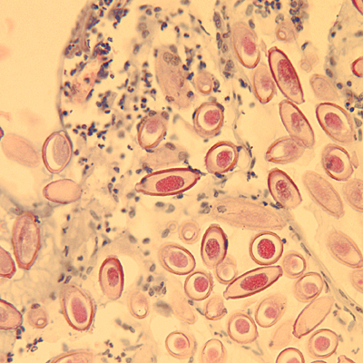 Case163_A.jpg