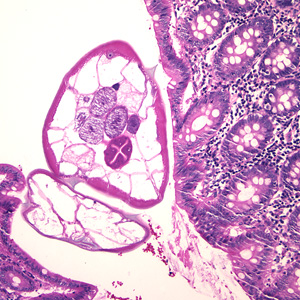 Case174_A.jpg