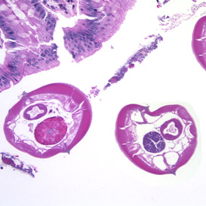 Case174_B.jpg