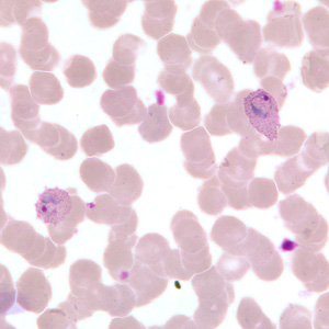 Case255_A.jpg
