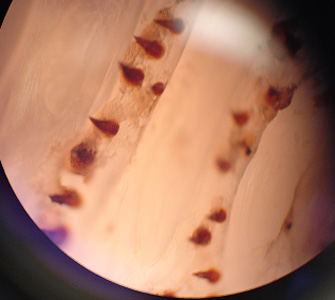 Case316_D.jpg
