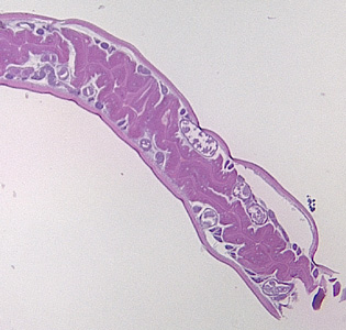 Case355_C.jpg