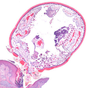 Case364_A.jpg