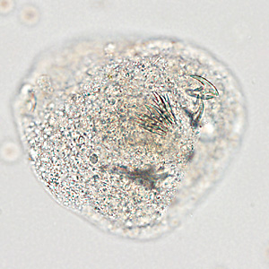 Case366_B.jpg