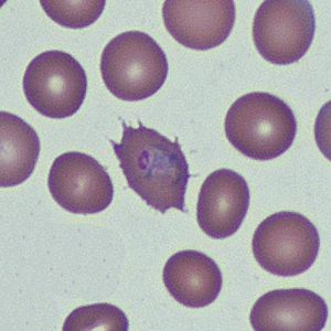Case368_A.jpg