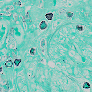 Case369_B.jpg