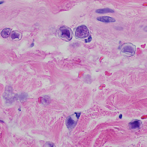 Case369_C.jpg