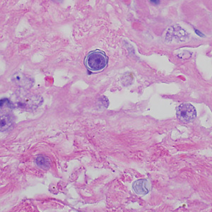 Case369_D.jpg