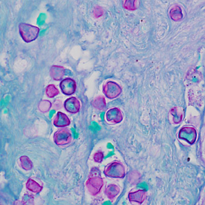 Case369_E.jpg
