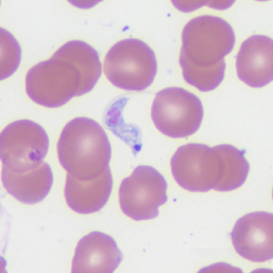 Case372_B.jpg