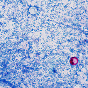 Case374_A.jpg