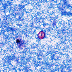 Case374_B.jpg