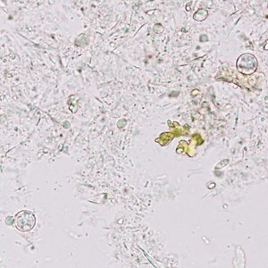 Case374_C.jpg