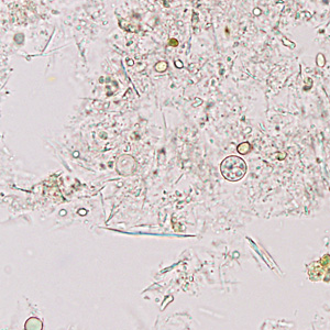 Case374_E.jpg