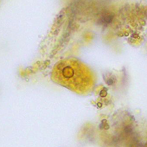 Case376_B.jpg