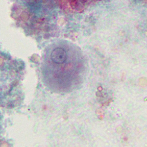 Case376_C.jpg