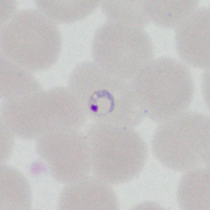 Case377_A.jpg