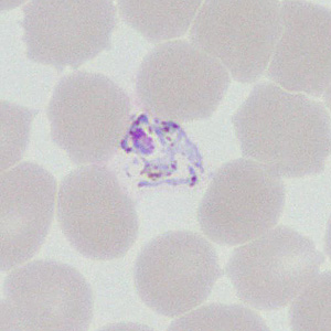 Case377_C.jpg