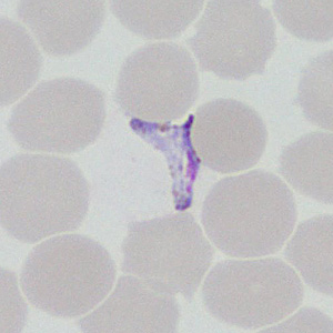 Case377_F.jpg