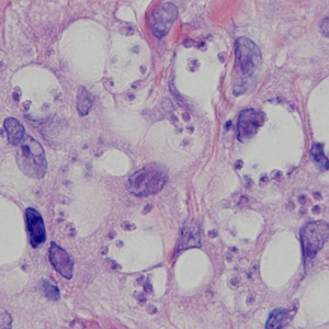 Case378_A.jpg