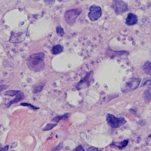 Case378_D.jpg