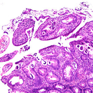 Case380_A.jpg