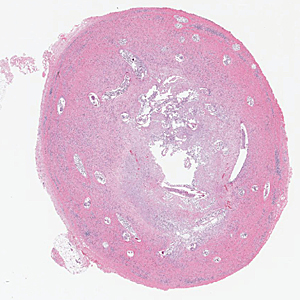 Case384_A.jpg